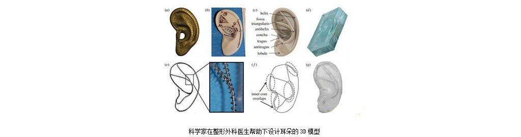 我国人工耳蜗市场简析