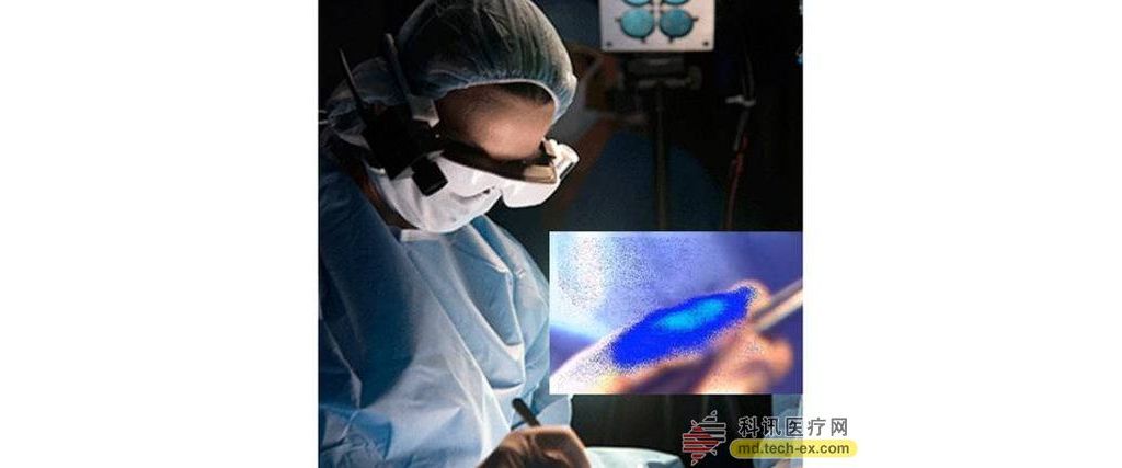 医疗智能眼镜问世 可帮助外科医生看到癌细胞