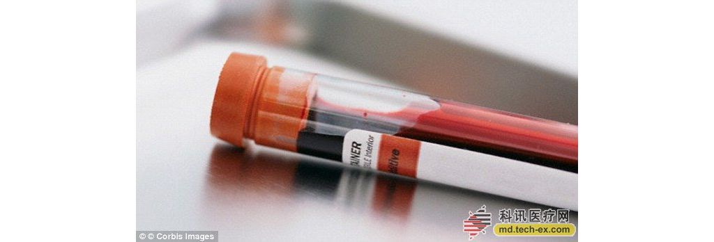 英国研发出新式血液检测方法能准确检出所有癌症