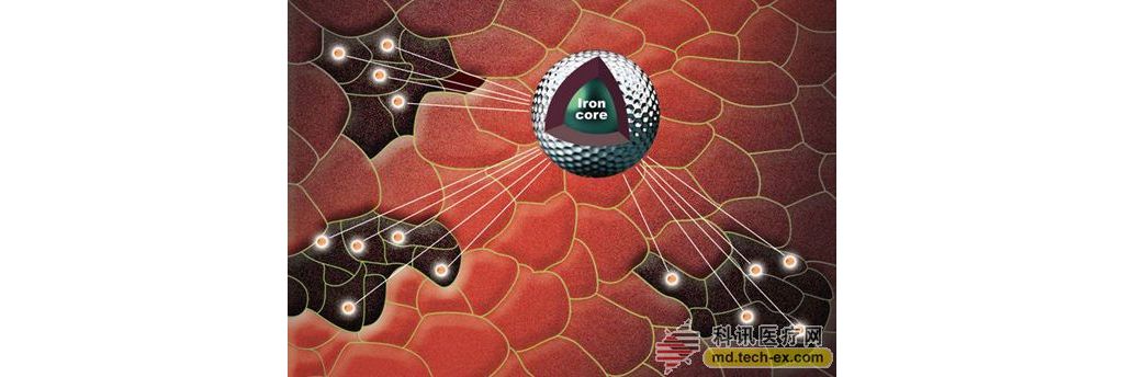 谷歌正开发纳米磁性粒子 可用于癌症早期诊断