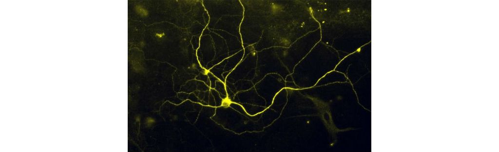 历时六年，科学家成功将皮肤细胞转化为痛觉神经元