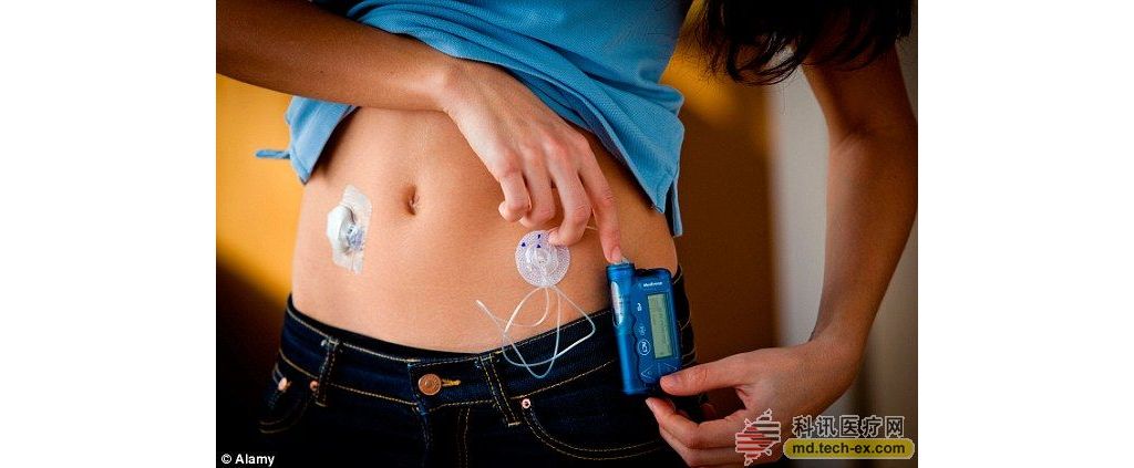 新式呼吸检测设备可早期诊断儿童I型糖尿病