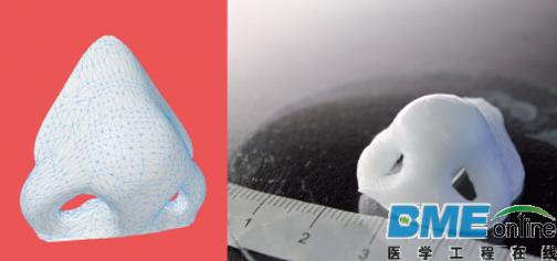 只要16 分钟，3D 打印鼻软骨就成功