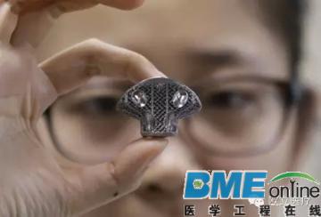 浅谈金属3D打印在骨科植入物领域的应用