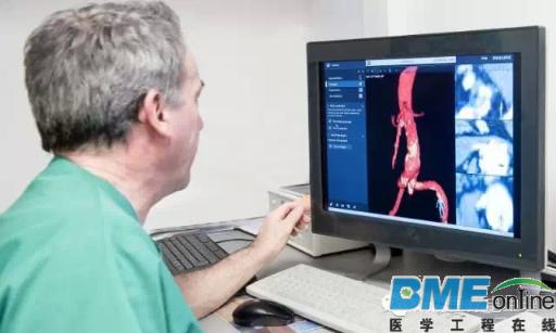 Philips推出治疗血管疾病新的3D导航系统