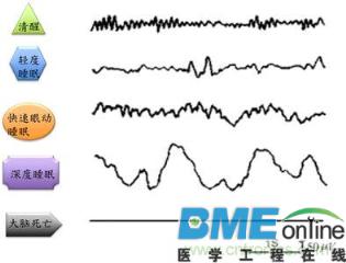 超低频生物电磁导入技术