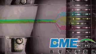 盘点：2015十大医疗黑科技