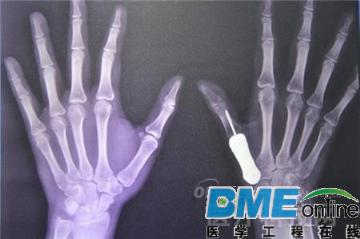 OFweek可穿戴设备网