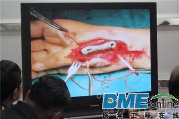 OFweek可穿戴设备网