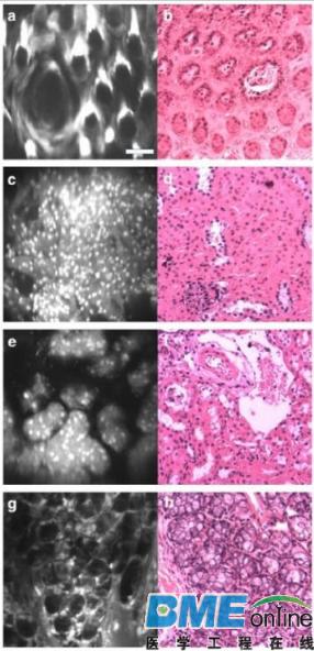 手术时不再&ldquo;雾里看花&rdquo;？这款微型显微镜能够实现实时镜检