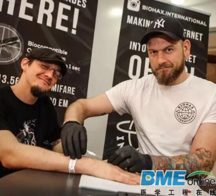 从可穿戴设备到人体植入 今后的医疗会变成这样