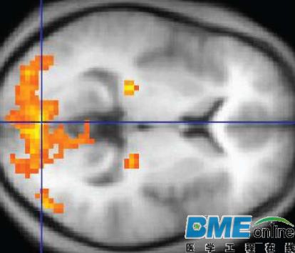 PNAS:大脑中数学运算和语言的神经网络系统不同