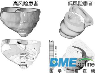 美科学家发明“虚拟心脏”，可以为心律失常患者提前预警