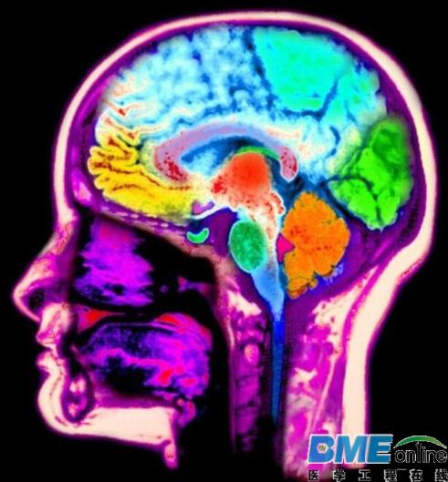 科学家发现大脑有调节音量的功能