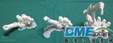 澳洲医生将4D打印和CT扫描技术用于术前规划