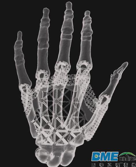 艺术家正用3D打印支架和干细胞