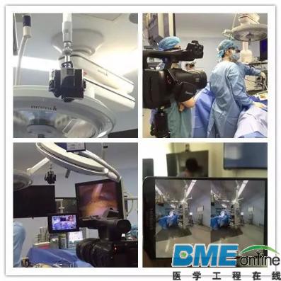 国内医院首次成功运用VR虚拟现实技术实现3D腹腔镜手术直播