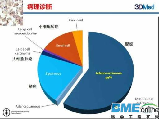【深度】基因组大数据如何塑造肿瘤精准治疗