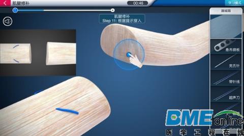 医微讯欲用“医疗＋VR”来改变外科学习方式