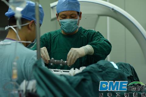 世界首个3D打印人工脊椎植入成功