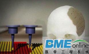 3D打印助力精准医疗：不仅能修复骨骼还能用于外科手术