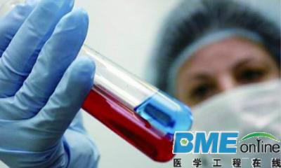 血检有望2019年实现癌症早期诊断