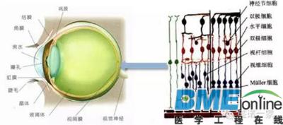 Argus II：可穿戴医疗设备帮助盲人重见光明