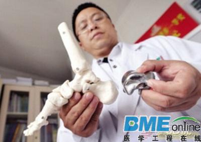3D打印应用越来越广：打印距骨帮助病患再次直立行走