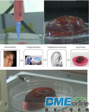 3D技术还可以打印人体器官