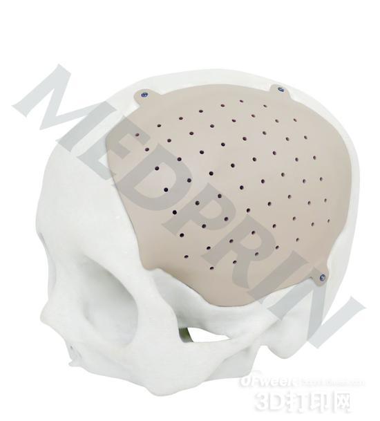 【视点】我们离3D打印器官和应用还有多远？