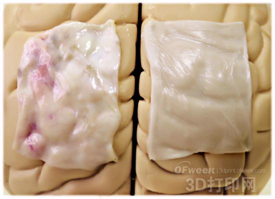 【视点】我们离3D打印器官和应用还有多远？