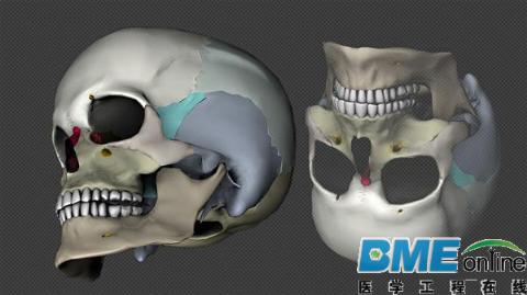 新西兰科学家利用生物医疗3D打印和干细胞制造出可再生新骨骼