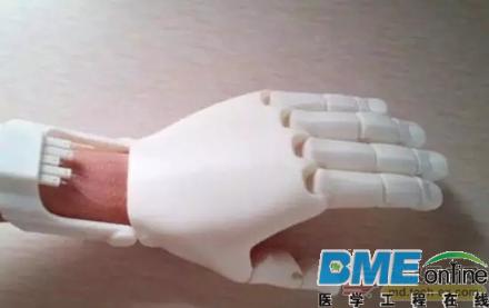 MIT科学家研究手指动力学 开源3D打印假手技术