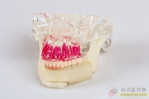 3D Systems推出牙科虚拟手术规划解决方案Jaw in a Day