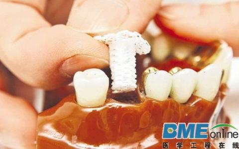 新加坡研究人员发明出生物医疗3D打印支架可助骨骼生长