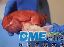 3D打印医学模型为医疗界带来另一番崭新局面