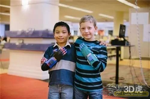 马耳他学生设计出可检测人体健康状态的3D打印假肢