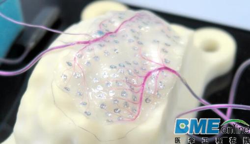 日本研发大脑植入电极技术：可解救渐冻人患者