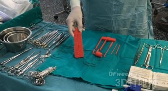 西班牙医生借助3D打印手术医疗器械治疗患者