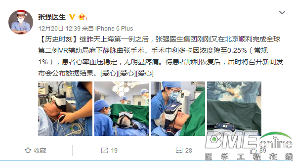 张强医生利用虚拟现实技术辅助静脉曲张手术
