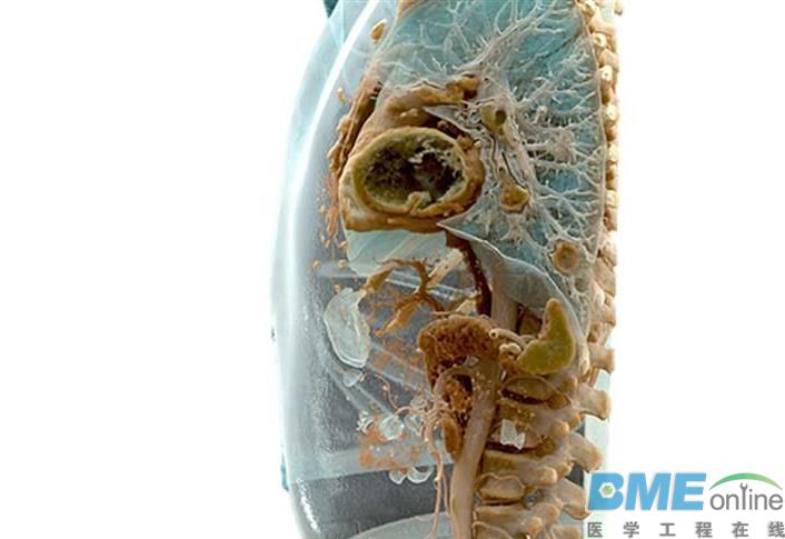亚洲首批医疗3D打印公司再获100万美元投资
