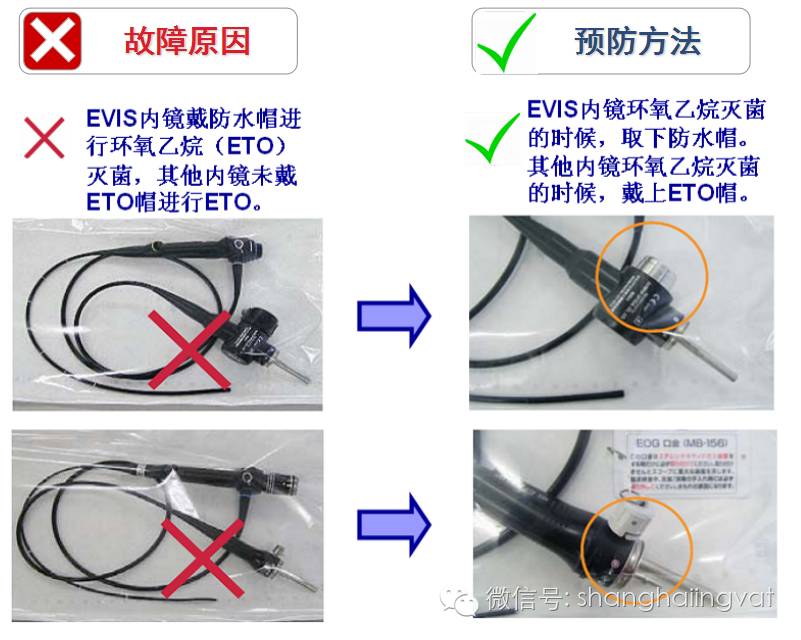 内镜消毒注意事项