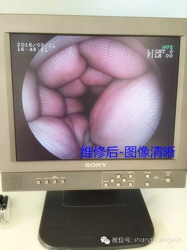 【FUJINON电子肠镜EC-200MR维修案例】