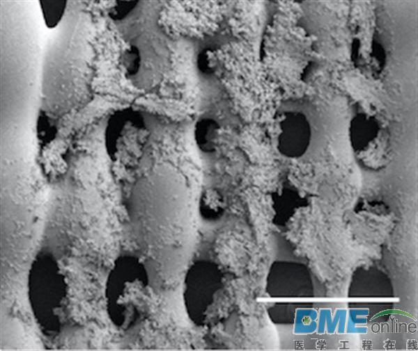 3D打印支架助科学家在骨癌研究上取新进展