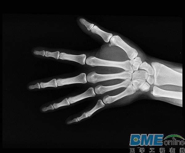 3D打印支架助科学家在骨癌研究上取新进展