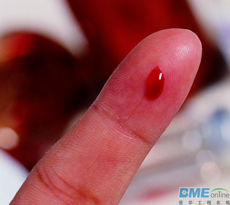 只需一滴血即可诊断胰腺癌?