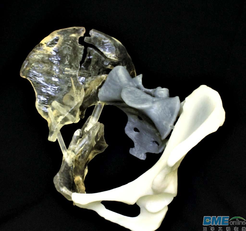 从迪拜到中国香港 谈医疗3D打印的新进展