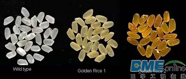 华人科学家发现老年痴呆症的源头或可追溯到出生前
