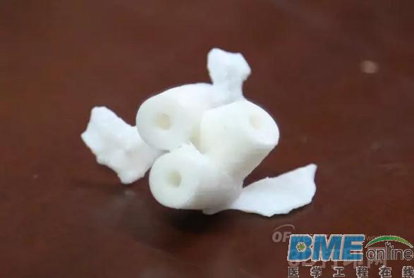 3D打印医学应用：颈椎“换柱”