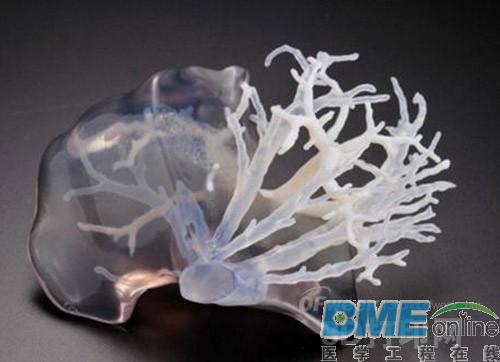 全球3D打印医疗器械发展将迎来“井喷”